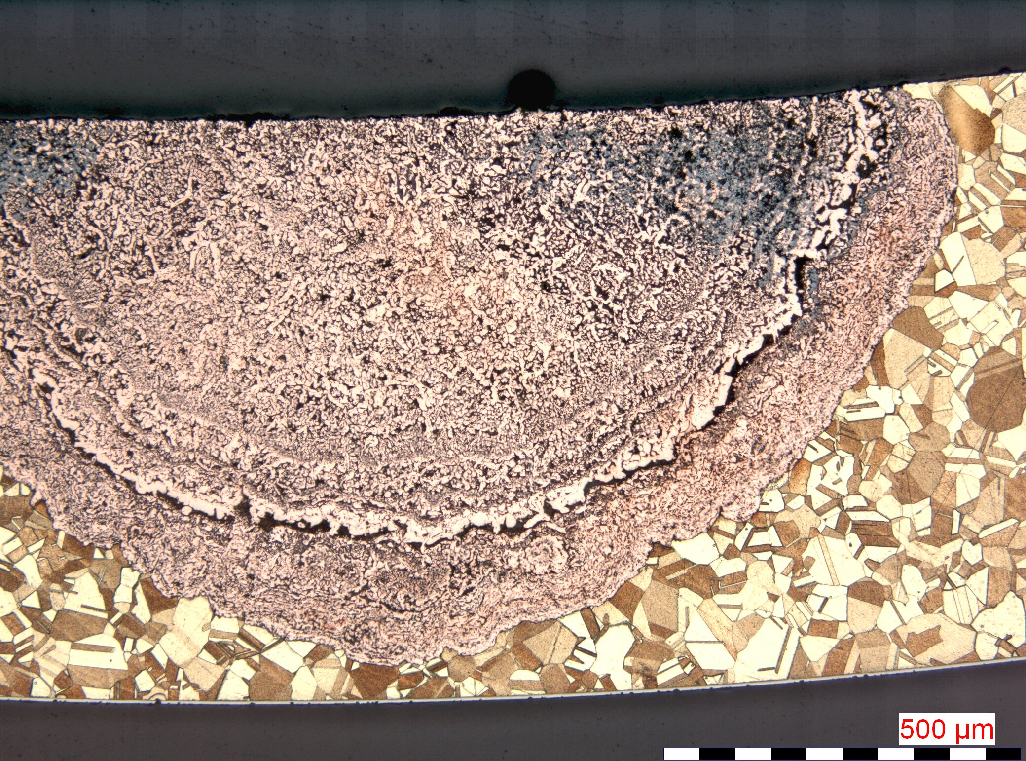 Pfropfenentzinkung unter einem Mikroskop. Nahaufnahme des Materials